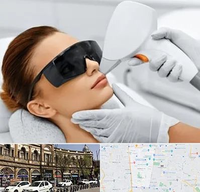 مرکز لیزر مو در منطقه 11 تهران