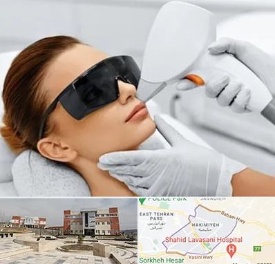 مرکز لیزر مو در حکیمیه