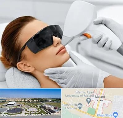 مرکز لیزر مو در ملارد