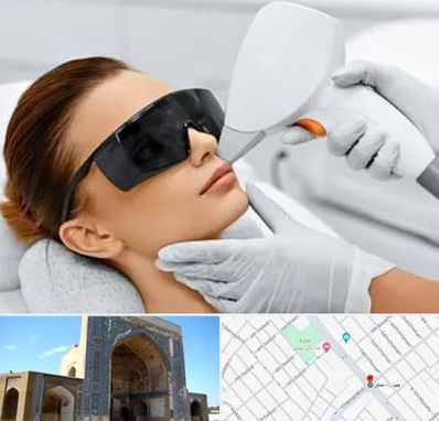 مرکز لیزر مو در مصلی مشهد