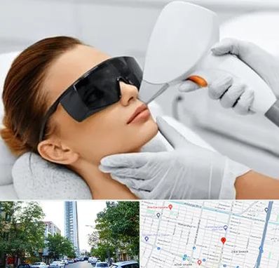 مرکز لیزر مو در امامت مشهد