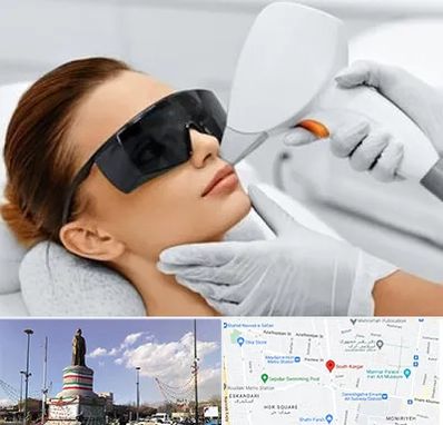 مرکز لیزر مو در کارگر جنوبی