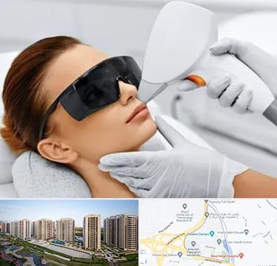 مرکز لیزر مو در المپیک