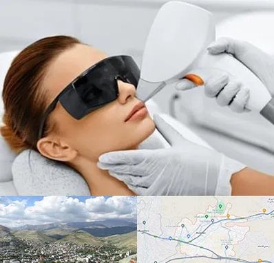 مرکز لیزر مو در رودهن