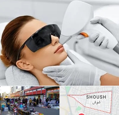 مرکز لیزر مو در شوش