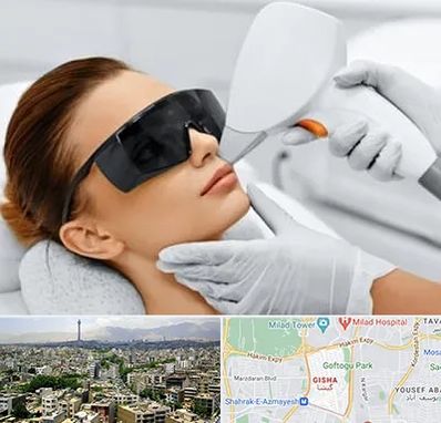مرکز لیزر مو در گیشا