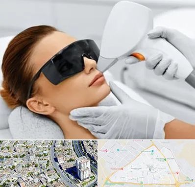 مرکز لیزر مو در قاسم آباد مشهد