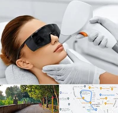 مرکز لیزر مو در بلوار گیلان رشت