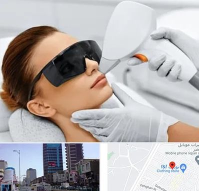 مرکز لیزر مو در چهارراه طالقانی کرج