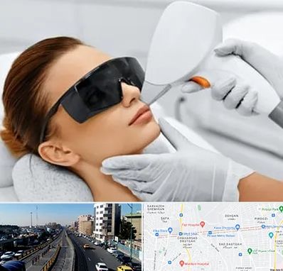 مرکز لیزر مو در پیروزی