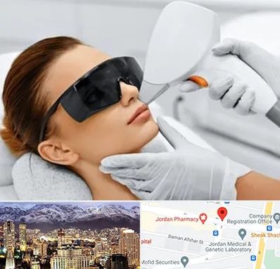 مرکز لیزر مو در جردن