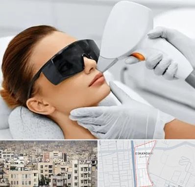 مرکز لیزر مو در اسکندری