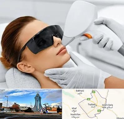 مرکز لیزر مو در تایباد