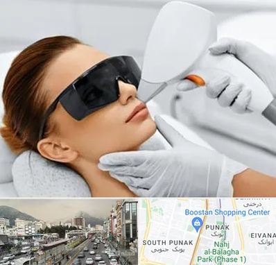 مرکز لیزر مو در پونک