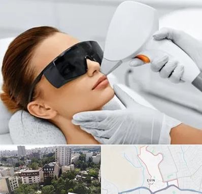 مرکز لیزر مو در اوین