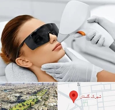 مرکز لیزر مو در شهرک گلستان