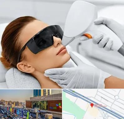 مرکز لیزر مو در لاله پارک تبریز