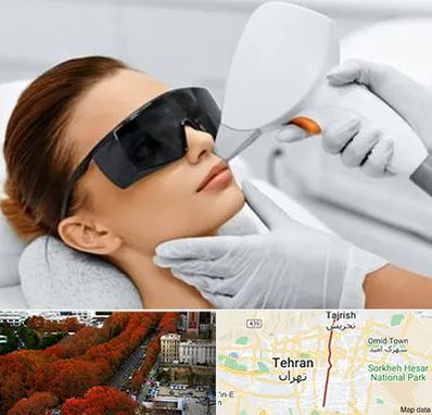 مرکز لیزر مو در ولیعصر