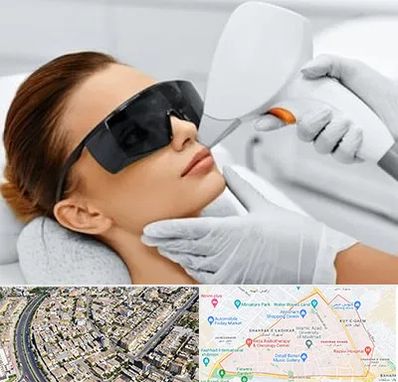 مرکز لیزر مو در شهرک غرب مشهد