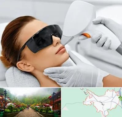 مرکز لیزر مو در فومن