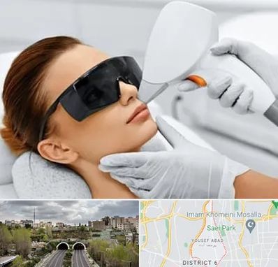 مرکز لیزر مو در یوسف آباد