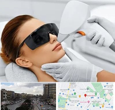 مرکز لیزر مو در بلوار فردوسی مشهد