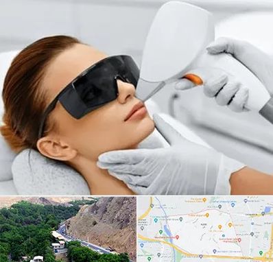 مرکز لیزر مو در کن