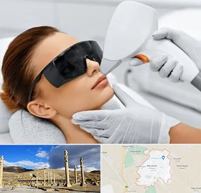 مرکز لیزر مو در مرودشت