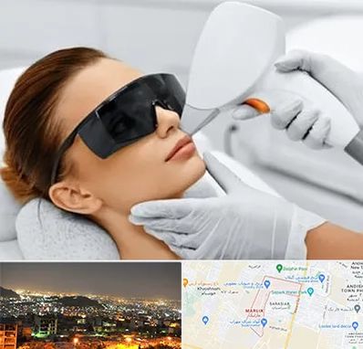 مرکز لیزر مو در مارلیک کرج