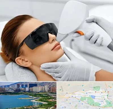 مرکز لیزر مو در منطقه 22 تهران