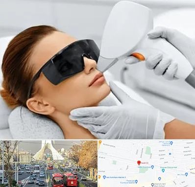 مرکز لیزر مو در خیابان آزادی