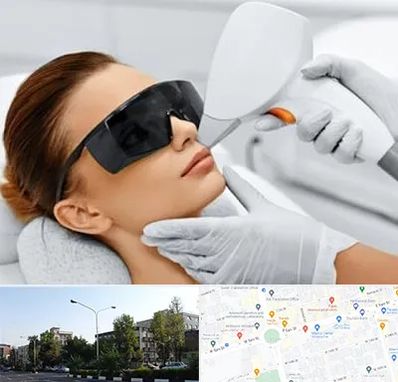 مرکز لیزر مو در میدان کاج