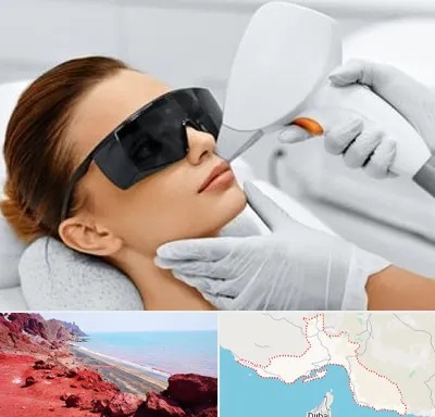 مرکز لیزر مو در هرمزگان