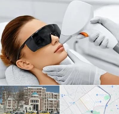 مرکز لیزر مو در طلاب مشهد