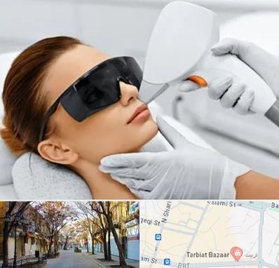 مرکز لیزر مو در تربیت تبریز