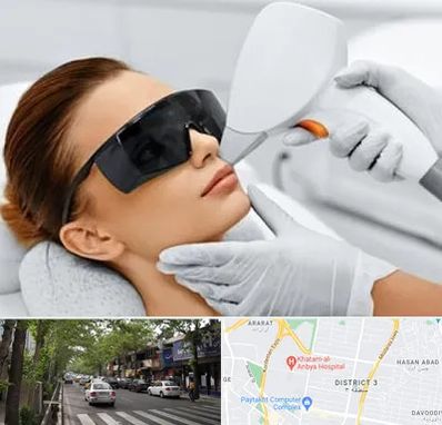 مرکز لیزر مو در ظفر