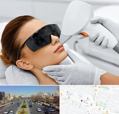 مرکز لیزر مو در بلوار معلم مشهد