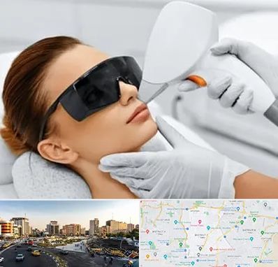 مرکز لیزر مو در منطقه 7 تهران