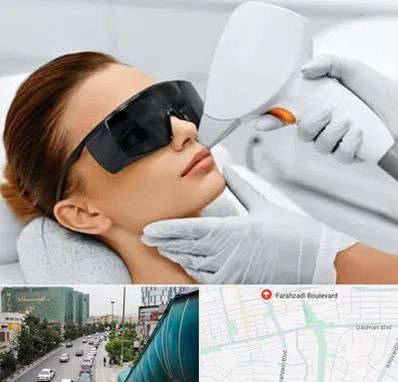 مرکز لیزر مو در بلوار فرحزادی