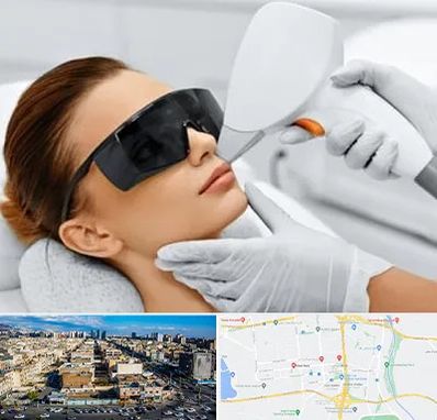 مرکز لیزر مو در شهرک راه آهن