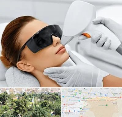 مرکز لیزر مو در منطقه 13 تهران