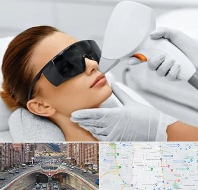 مرکز لیزر مو در منطقه 10 تهران