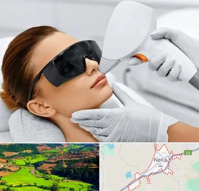 مرکز لیزر مو در نکا