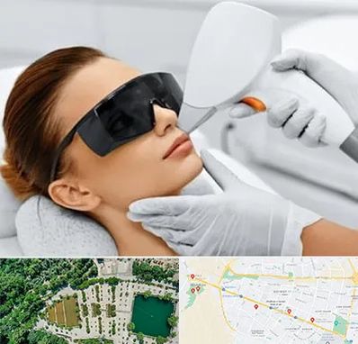 مرکز لیزر مو در وکیل آباد مشهد