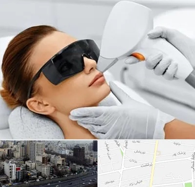 مرکز لیزر مو در زرتشت