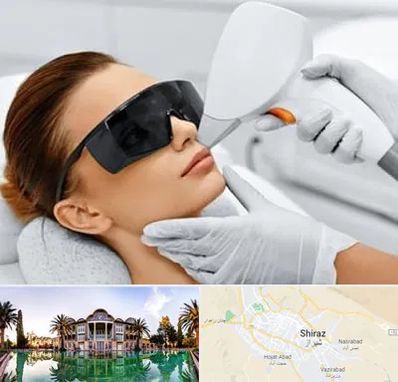 مرکز لیزر مو در شیراز