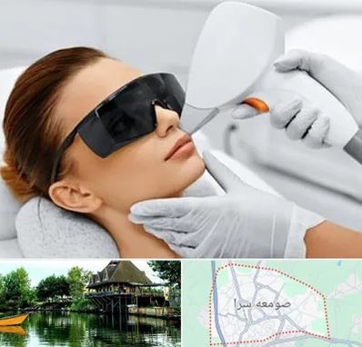 مرکز لیزر مو در صومعه سرا
