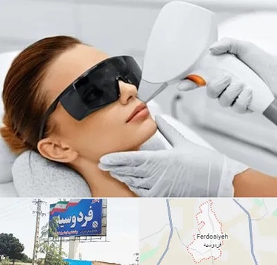 مرکز لیزر مو در فردوسیه شهریار
