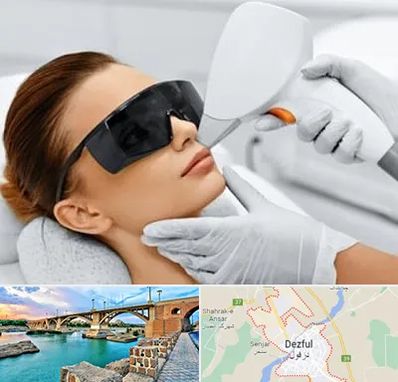 مرکز لیزر مو در دزفول