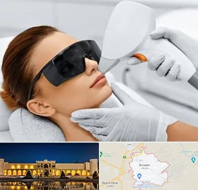 مرکز لیزر مو در برازجان
